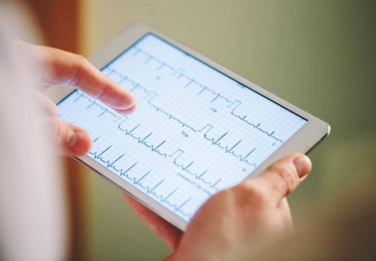 Remote Heart Monitoring Platform Monitra Healthcare Raises USD 500K in Pre-Series A funding, Led by 91Ventures and Lavni Ventures