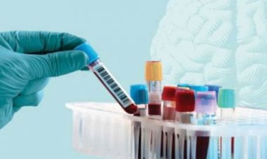 Potential Breakthrough: Blood Test May Predict Dementia a Decade Early