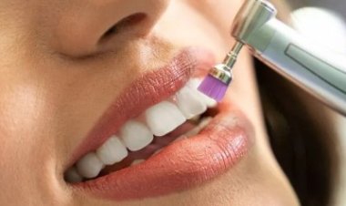 Teeth Scaling and Polishing in Islamabad: A Gentle Way to Clean Teeth