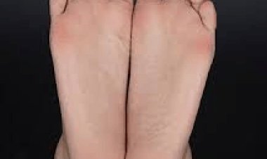 Causes of Blackened Skin on the Soles of Feet
