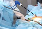 Trusted Laparoscopic Surgery in Islamabad