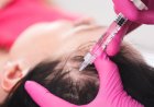 How Often Should You Get PRP Hair Treatment?