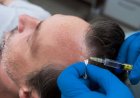 Hair Loss Treatment in Islamabad: Restore Your Confidence Today