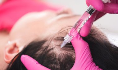 How Often Should You Get PRP Hair Treatment?