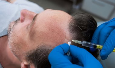 Hair Loss Treatment in Islamabad: Restore Your Confidence Today