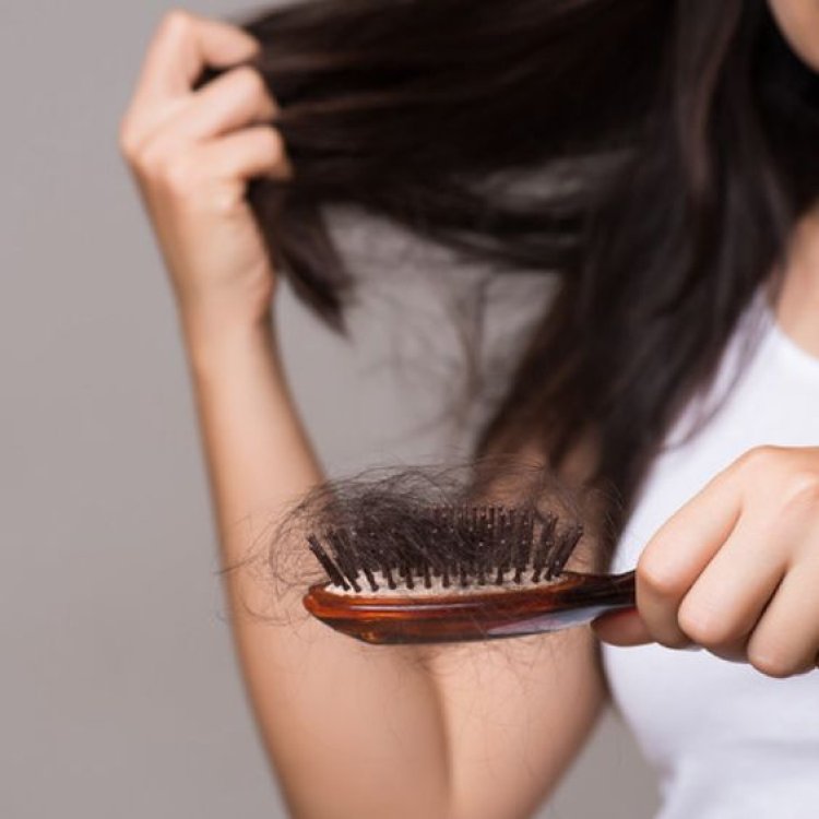 Best Hair Clinic in Noida for Alopecia, Baldness & Severe Hair Fall