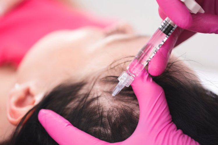 How Often Should You Get PRP Hair Treatment?