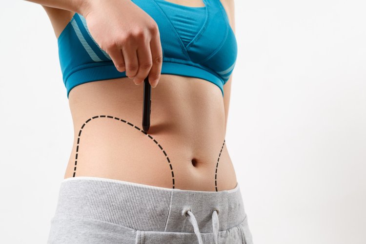 How Liposuction in Dubai Supports Safe and Precise Body Shaping