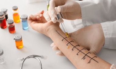 Choosing an Allergist Doctor Dubai for Allergy Relief