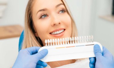 Veneers in Dubai: Treatment Steps and Key Benefits