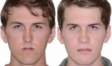 How Long Does Recovery Take After Jaw Surgery in Islamabad?