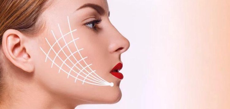 How Islamabad Clinics Personalize Thread Lift Treatments