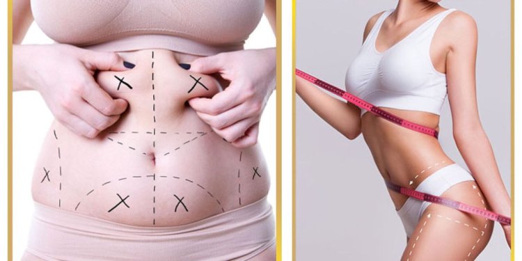 How Age Affects Liposuction Results in Islamabad