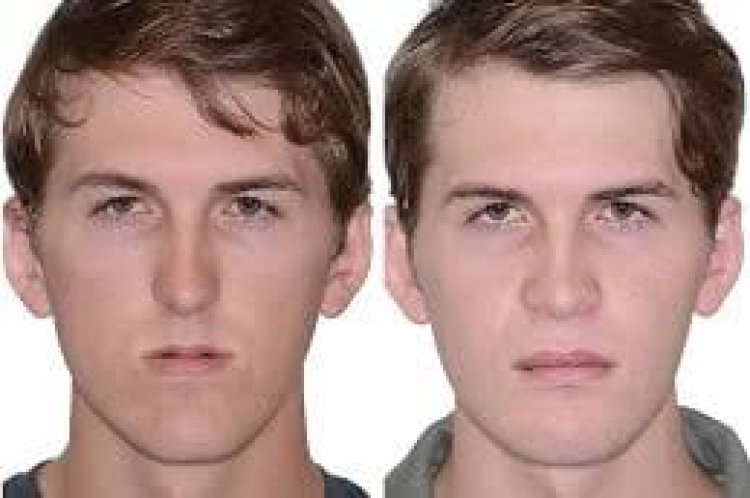 How Long Does Recovery Take After Jaw Surgery in Islamabad?