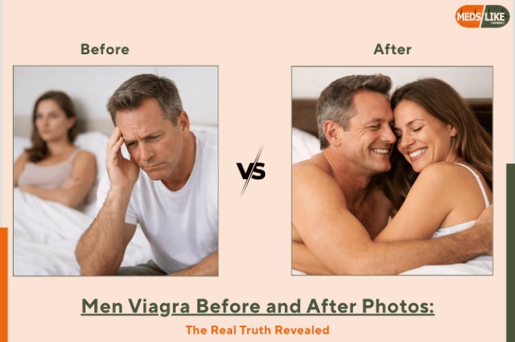 Men Viagra Before After Pictures | What to Expect from Treatment