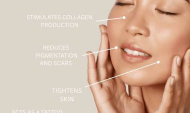Can Pico Laser Treatment in Islamabad Improve Pores?