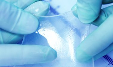 How Amniotic Membrane Products Are Advancing Modern Wound Care