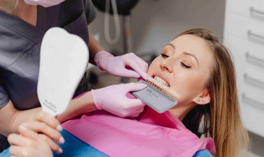 Top-Rated Cosmetic Dentists in Boston (Veneers & Whitening)